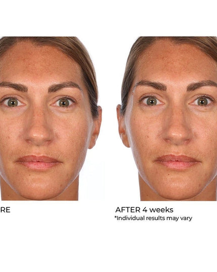 Improve chronic rough skin texture with just a few swipes! These skin retexturizing treatment pads have a proprietary synergistic blend of, Niacinamide, Hyaluronic Acid, Retinol and Mandelic Acid. The slower but deeper absorption rate of mandelic acid helps supercharge all ingredient benefits, resulting in smoother, brighter, more even looking skin. Skip the lasers at the medical spa and give these a try, you’ll see progressive improvement over just 4 weeks!