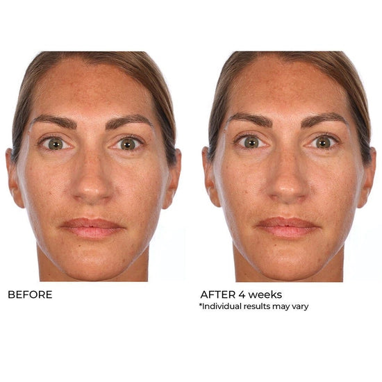 Improve chronic rough skin texture with just a few swipes! These skin retexturizing treatment pads have a proprietary synergistic blend of, Niacinamide, Hyaluronic Acid, Retinol and Mandelic Acid. The slower but deeper absorption rate of mandelic acid helps supercharge all ingredient benefits, resulting in smoother, brighter, more even looking skin. Skip the lasers at the medical spa and give these a try, you’ll see progressive improvement over just 4 weeks!