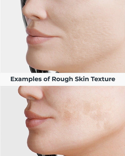 Improve chronic rough skin texture with just a few swipes! These skin retexturizing treatment pads have a proprietary synergistic blend of, Niacinamide, Hyaluronic Acid, Retinol and Mandelic Acid. The slower but deeper absorption rate of mandelic acid helps supercharge all ingredient benefits, resulting in smoother, brighter, more even looking skin. Skip the lasers at the medical spa and give these a try, you’ll see progressive improvement over just 4 weeks!