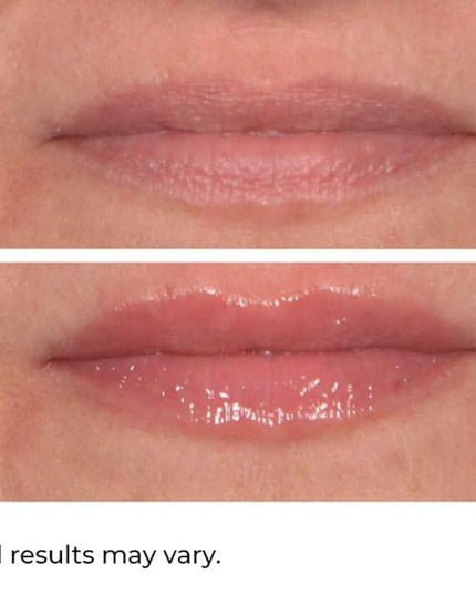 Soften, moisturize and plump lips with this advanced serum which uses hyaluronic acid and ceramides to sink deep into the skin to enhance moisture retention, build up the skin’s barrier and deliver intense hydration. With Volulip™ and Jojoba Glaze® to hydrate and smooth lips and act as a shield to retain moisture and provide a shine boost, lips appear plumper, smoother and more youthful.