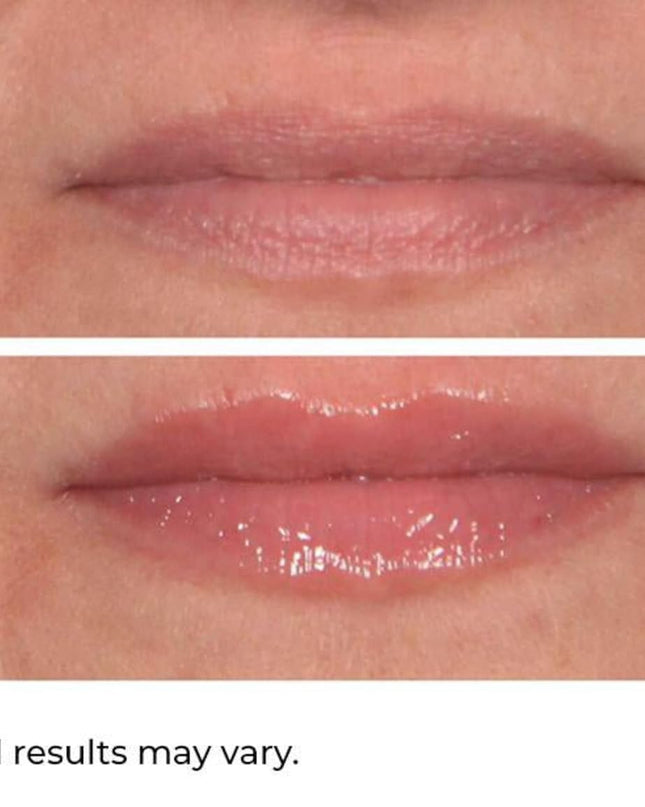 Soften, moisturize and plump lips with this advanced serum which uses hyaluronic acid and ceramides to sink deep into the skin to enhance moisture retention, build up the skin’s barrier and deliver intense hydration. With Volulip™ and Jojoba Glaze® to hydrate and smooth lips and act as a shield to retain moisture and provide a shine boost, lips appear plumper, smoother and more youthful.