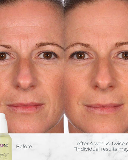 This is an advanced technology serum formulated with a blend of Hyaluronic Acid, Ceramides, and Sytenol A to deliver intense hydration to the skin &amp; reduce wrinkles. Use it on your whole body for a soft and youthful look. Our best-selling serum takes a 360 approach to fast, visible anti-aging results and truly healthier skin. You’ll notice deep hydration, bounciness, brighter tone, smoother texture, and youthful resilience.