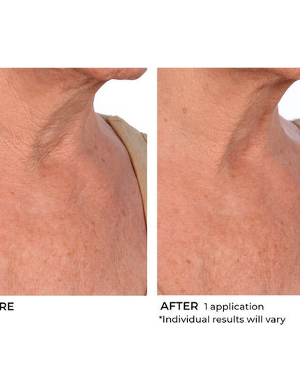 Deliver intense hydration to your face and body with this lightweight, moisturizing soufflé. Boasting a proprietary blend of hyaluronic acid, essential ceramides and sytenol A, this nourishing formula helps improve tone and firmness while moisturizing dry skin and smoothing the appearance of wrinkles for a more radiant look and feel.