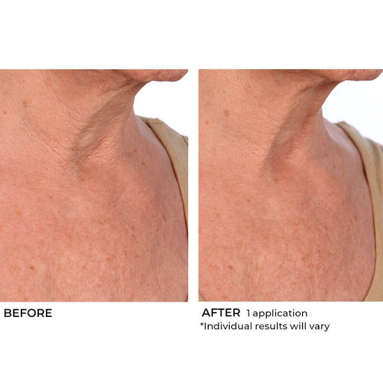 Deliver intense hydration to your face and body with this lightweight, moisturizing soufflé. Boasting a proprietary blend of hyaluronic acid, essential ceramides and sytenol A, this nourishing formula helps improve tone and firmness while moisturizing dry skin and smoothing the appearance of wrinkles for a more radiant look and feel.