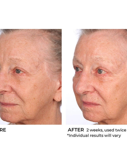 Deliver intense hydration to your face and body with this lightweight, moisturizing soufflé. Boasting a proprietary blend of hyaluronic acid, essential ceramides and sytenol A, this nourishing formula helps improve tone and firmness while moisturizing dry skin and smoothing the appearance of wrinkles for a more radiant look and feel.