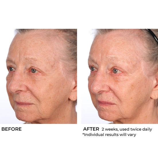 Deliver intense hydration to your face and body with this lightweight, moisturizing soufflé. Boasting a proprietary blend of hyaluronic acid, essential ceramides and sytenol A, this nourishing formula helps improve tone and firmness while moisturizing dry skin and smoothing the appearance of wrinkles for a more radiant look and feel.