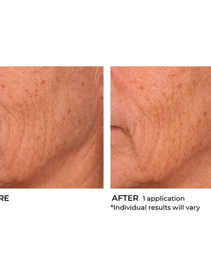 Deliver intense hydration to your face and body with this lightweight, moisturizing soufflé. Boasting a proprietary blend of hyaluronic acid, essential ceramides and sytenol A, this nourishing formula helps improve tone and firmness while moisturizing dry skin and smoothing the appearance of wrinkles for a more radiant look and feel.