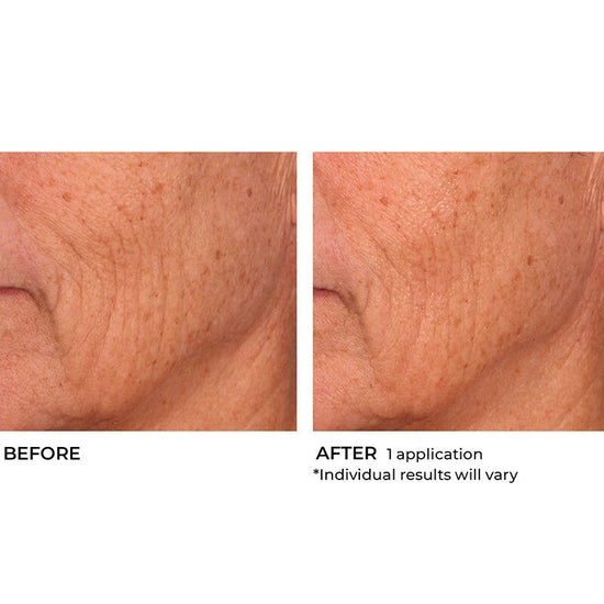 Deliver intense hydration to your face and body with this lightweight, moisturizing soufflé. Boasting a proprietary blend of hyaluronic acid, essential ceramides and sytenol A, this nourishing formula helps improve tone and firmness while moisturizing dry skin and smoothing the appearance of wrinkles for a more radiant look and feel.