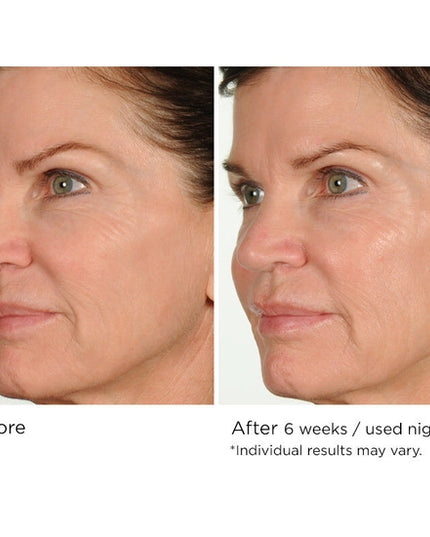 Fight the multiple signs of aging overnight with this advanced nighttime serum that helps reduce the appearance of fine lines and wrinkles while you sleep. Formulated with AcquaCell, a natural complex of fruit extracts, Innumax Retinol, and vitamin C to fight free radical damage and brighten the complexion, this deep- and fast-penetrating face serum helps create a more youthful look and feel through its restorative, protective qualities.