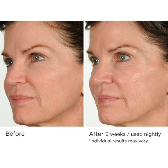 Fight the multiple signs of aging overnight with this advanced nighttime serum that helps reduce the appearance of fine lines and wrinkles while you sleep. Formulated with AcquaCell, a natural complex of fruit extracts, Innumax Retinol, and vitamin C to fight free radical damage and brighten the complexion, this deep- and fast-penetrating face serum helps create a more youthful look and feel through its restorative, protective qualities.