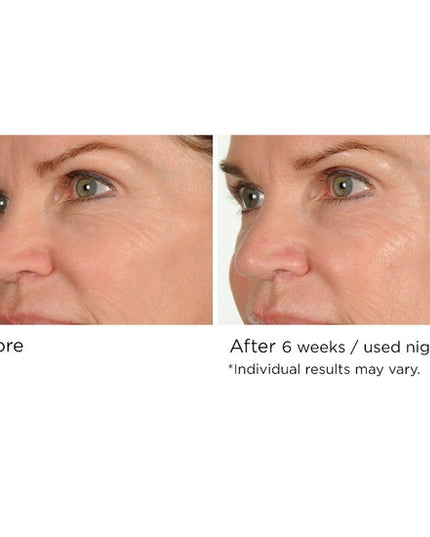 Fight the multiple signs of aging overnight with this advanced nighttime serum that helps reduce the appearance of fine lines and wrinkles while you sleep. Formulated with AcquaCell, a natural complex of fruit extracts, Innumax Retinol, and vitamin C to fight free radical damage and brighten the complexion, this deep- and fast-penetrating face serum helps create a more youthful look and feel through its restorative, protective qualities.