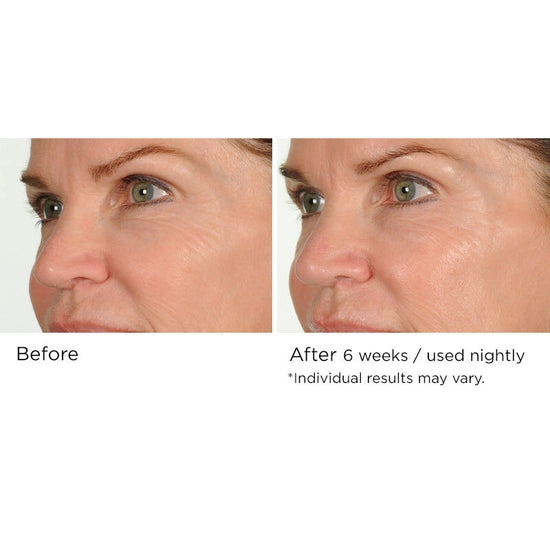 Fight the multiple signs of aging overnight with this advanced nighttime serum that helps reduce the appearance of fine lines and wrinkles while you sleep. Formulated with AcquaCell, a natural complex of fruit extracts, Innumax Retinol, and vitamin C to fight free radical damage and brighten the complexion, this deep- and fast-penetrating face serum helps create a more youthful look and feel through its restorative, protective qualities.