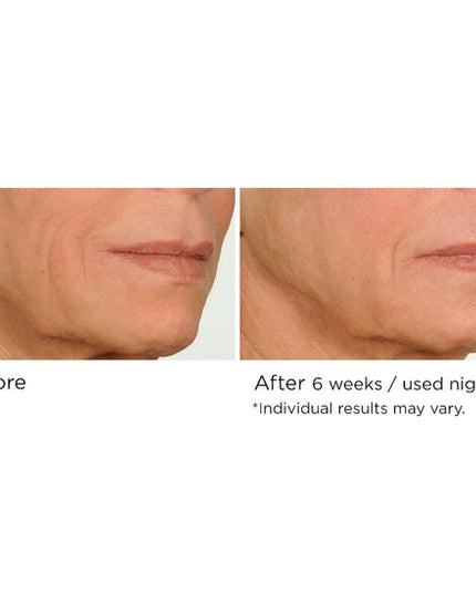 Fight the multiple signs of aging overnight with this advanced nighttime serum that helps reduce the appearance of fine lines and wrinkles while you sleep. Formulated with AcquaCell, a natural complex of fruit extracts, Innumax Retinol, and vitamin C to fight free radical damage and brighten the complexion, this deep- and fast-penetrating face serum helps create a more youthful look and feel through its restorative, protective qualities.