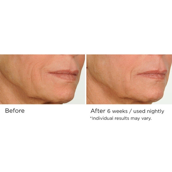 Fight the multiple signs of aging overnight with this advanced nighttime serum that helps reduce the appearance of fine lines and wrinkles while you sleep. Formulated with AcquaCell, a natural complex of fruit extracts, Innumax Retinol, and vitamin C to fight free radical damage and brighten the complexion, this deep- and fast-penetrating face serum helps create a more youthful look and feel through its restorative, protective qualities.