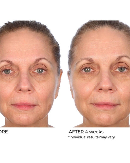 Help reverse the signs of aging, dark spots, and sun damage with Dr. Nassif’s clinically proven, concentrated 10% Vitamin C treatment serum! More youthful-looking skin is a few drops away!