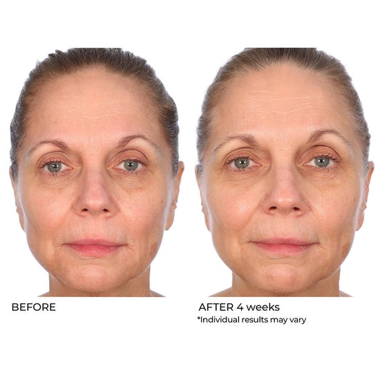 Help reverse the signs of aging, dark spots, and sun damage with Dr. Nassif’s clinically proven, concentrated 10% Vitamin C treatment serum! More youthful-looking skin is a few drops away!