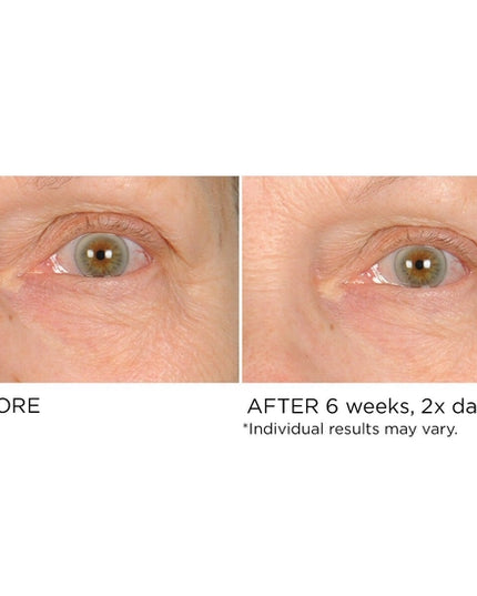 An under-eye cream with three powerful peptides to help awaken your look by stimulating skin micro-circulation to provide immediate and long-term reduction of undereye puffiness and wrinkles.By boosting collagen production while providing deep hydration, over time, you will notice an improvement in skin elasticity and dark circles