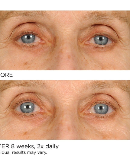 An under-eye cream with three powerful peptides to help awaken your look by stimulating skin micro-circulation to provide immediate and long-term reduction of undereye puffiness and wrinkles.By boosting collagen production while providing deep hydration, over time, you will notice an improvement in skin elasticity and dark circles