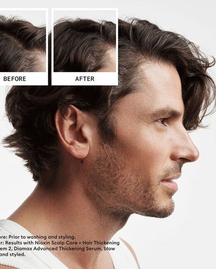 A volumizing leave-on treatment that contains antioxidants and botanicals that help to provide a refreshed scalp environment. It contains SPF 15 sunscreen to help protect the exposed scalp from the sun. For noticeably thinning, fine, natural hair.