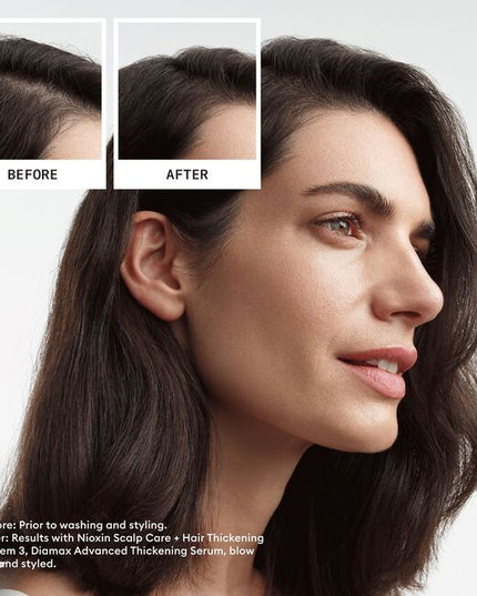 Volumizing cleanser helps to remove follicle-clogging sebum, fatty acids and environmental residues from the scalp and hair. Cleanses to provide thicker-looking hair.