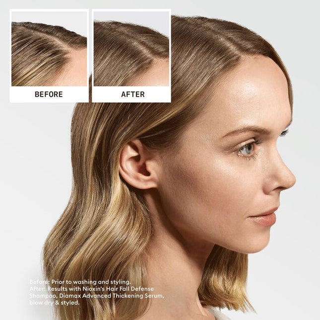 New, revolutionary Hair Fall Defense Shampoo removes build-up and is clinically proven to grow* stronger hair from the root.93% of people have less hair fall** and visible results in 12 weeks***.