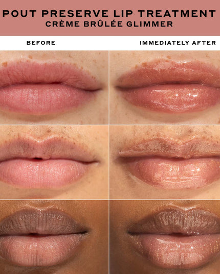 The viral lip treatment, now in a new glimmer finish. Sparkling lipcare, infused with lip-specific peptides and kokum butter, for clinically fuller-looking lips in just 1 week.*