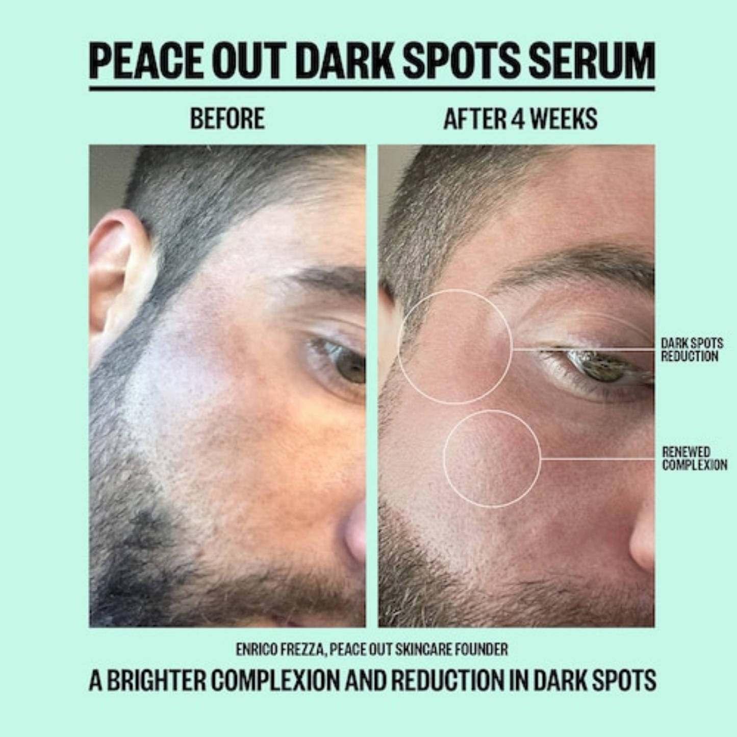 Peace Out Dark Spots Serum