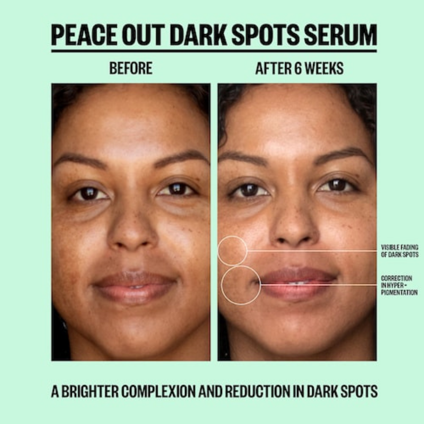 Peace Out Dark Spots Serum