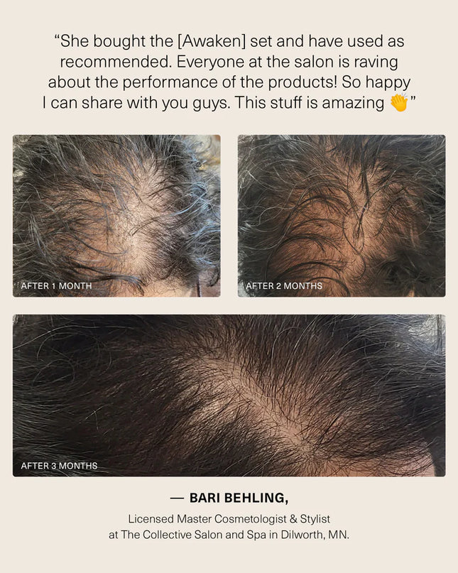 A clear and simple solution to revive scalp and hair

Advanced Therapeutic Treatment System Includes:

1- Awaken Therapeutic Shampoo 10 oz.
1- Awaken Therapeutic Conditioner 8 oz.
1- Awaken Therapeutic Treatment 2 oz.
1- Awaken Scalp Elixir 4 oz.