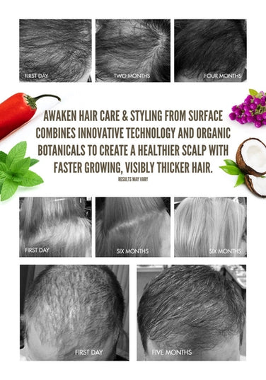 Surface's Awaken Therapuetic Conditioner promotes a healthy scalp and hair. Natural capsicum and menthol stimulate while vegan amaranth, soy and keravis proteins strengthen.