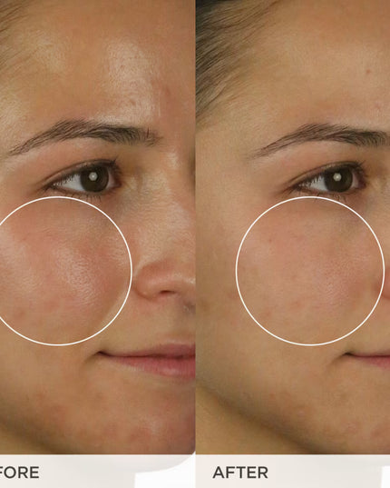 A matcha a day keeps oil away- daily gel cleanser with Japanese kyo-matcha, mugwort and coix seed that gently clarifies and moisturizes skin as it balances oil and pH levels for a clean, smooth complexion.