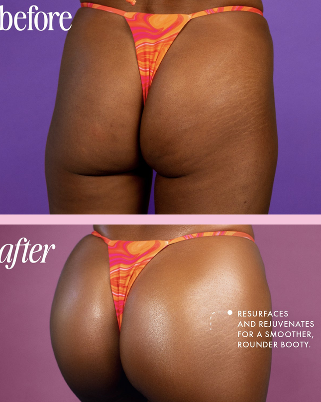 Give your tush an extra push with Truly's Buns Of Glowry Tighten & Glow Smoothing Butt Polish. Its two key ingredients are wheat protein and watermelon extract. Wheat protein's film-forming properties will increases firmness of the skin, while minimizing the appearance of fine lines and cellulite.