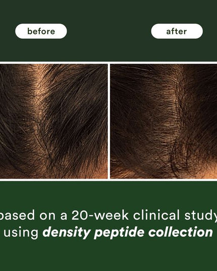A lightweight hair serum that visibly increases hair density and minimizes the appearance of thinning hair. Powered by our unique density complex, ginseng root extract and niacinamide, this serum visibly reduces signs of shedding for thicker, fuller-looking hair.