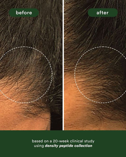 A density-boosting shampoo, powered by saw palmetto extract, ginseng root extract and niacinamide, that gently cleanses and helps minimize the appearance of shedding for a less visible scalp and thicker, fuller-looking hair.