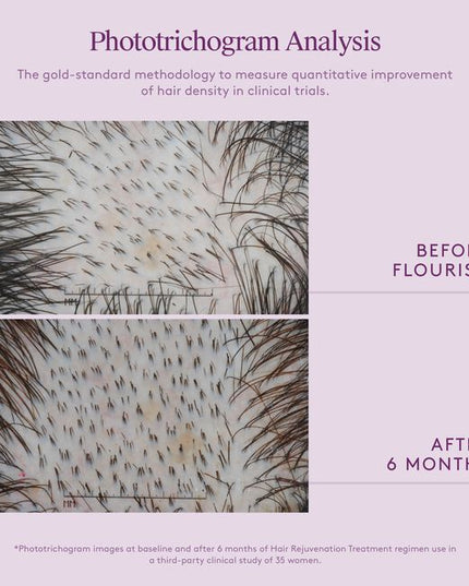 A 100% drug-free, botanical-based regimen that fuels fatigued follicles, nourishes the scalp, and thickens each hair. Virtue® Flourish®’s three-step system includes the Shampoo for Thinning Hair, Conditioner for Thinning Hair, and our drug-free Density Booster. This regimen is ideal for mild to moderate thinning and those seeking a more natural solution.