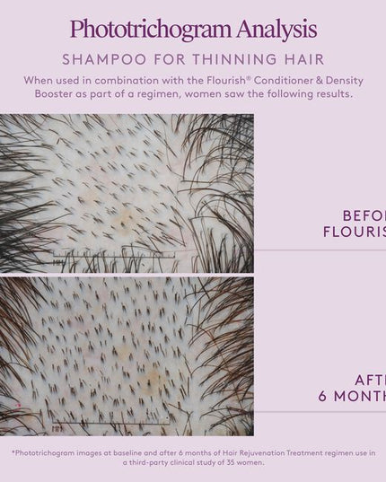 Virtue® Flourish® Shampoo for Thinning Hair delicately removes scalp buildup, cleanses the hair shaft, and clears debris from follicle openings, creating an environment for healthy growth.