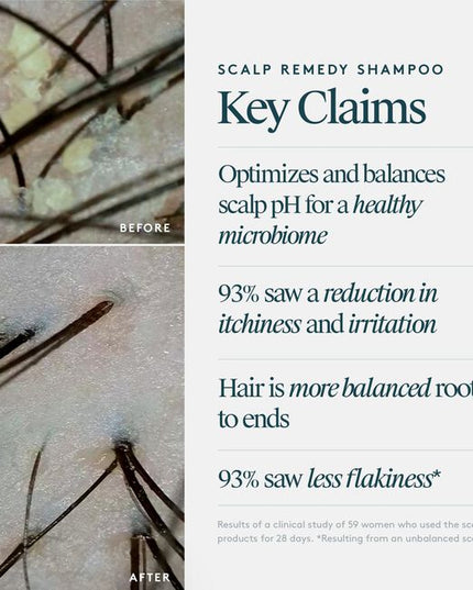 Virtue® Scalp Remedy Shampoo nourishes and balances the microbiome for optimal scalp health while providing residue-free scalp and hair cleansing for hydrated, refreshed hair. The unique, drug-free solution not only treats the root cause of an imbalanced scalp, but also instantly fixes the symptoms, such as dryness, flakiness, oiliness, sensitivity, or itching, all while repairing and strengthening hair to its healthiest state with the only 100% bio-identical keratin protein -- Alpha Keratin 60ku Clinical.