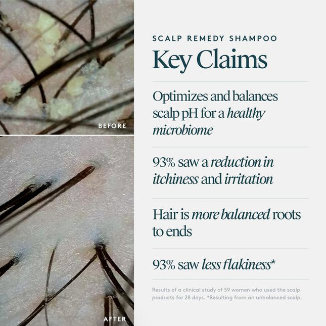 Virtue® Scalp Remedy Shampoo nourishes and balances the microbiome for optimal scalp health while providing residue-free scalp and hair cleansing for hydrated, refreshed hair. The unique, drug-free solution not only treats the root cause of an imbalanced scalp, but also instantly fixes the symptoms, such as dryness, flakiness, oiliness, sensitivity, or itching, all while repairing and strengthening hair to its healthiest state with the only 100% bio-identical keratin protein -- Alpha Keratin 60ku Clinical.