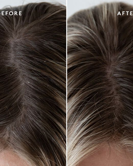 Virtue's scalp is a catchall for accumulated dirt, sebum, and product buildup. Virtue® Exfoliating Scalp Scrub, a light whipped crème, lifts impurities and aged cells to balance and condition without residue. Rice beads and fruit enzymes help exfoliate, while Kalahari melon and jojoba oils help moisturize. Alpha Keratin 60ku® repairs hair with every use.
