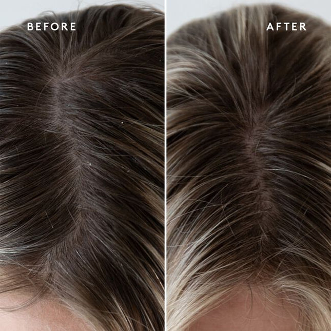 Virtue's scalp is a catchall for accumulated dirt, sebum, and product buildup. Virtue® Exfoliating Scalp Scrub, a light whipped crème, lifts impurities and aged cells to balance and condition without residue. Rice beads and fruit enzymes help exfoliate, while Kalahari melon and jojoba oils help moisturize. Alpha Keratin 60ku® repairs hair with every use.