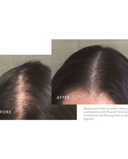 Used by millions, Minoxidil is the only FDA-approved, single-ingredient drug to help regrow hair in women. It works while you sleep, to reactivate the hair follicles and stimulate regrowth.