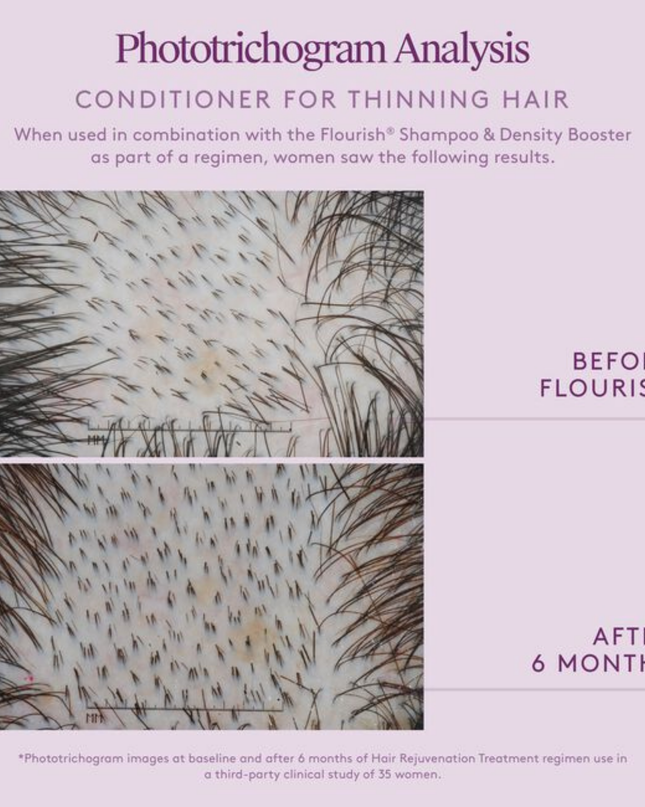 Virtue® Flourish® Conditioner for Thinning Hair is a lightweight hair strengthener, hydrator, and detangler in one. Nourishes and thickens fine, fragile strands without weighing down hair.