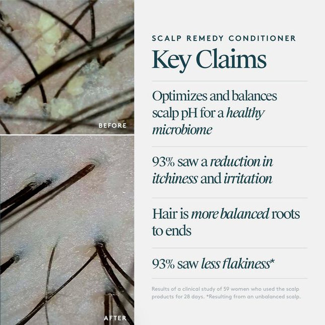  Virtue® Scalp Remedy Conditioner hydrates and nourishes from roots to ends while balancing the scalp’s delicate ecosystem so hair grows stronger and healthier. 