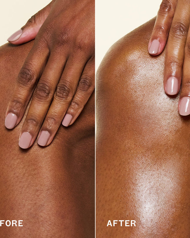 A rich, whipped body butter with moisturizing ceramides that’s clinically proven* to maintain hydration up to 48 hours for softer, smoother skin.
