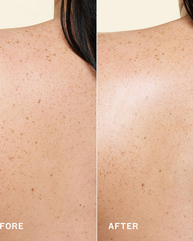 A clinically proven, fast-absorbing body oil with oil-soluble vitamin C that fades discoloration and evens skin tone* for a more radiant, all-day glow.