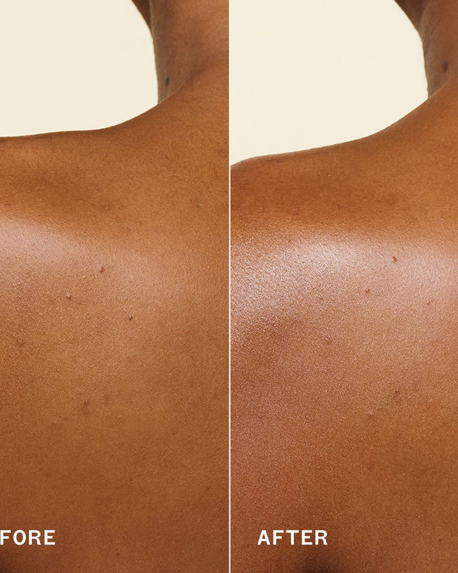 A clinically proven, fast-absorbing body oil with oil-soluble vitamin C that fades discoloration and evens skin tone* for a more radiant, all-day glow.